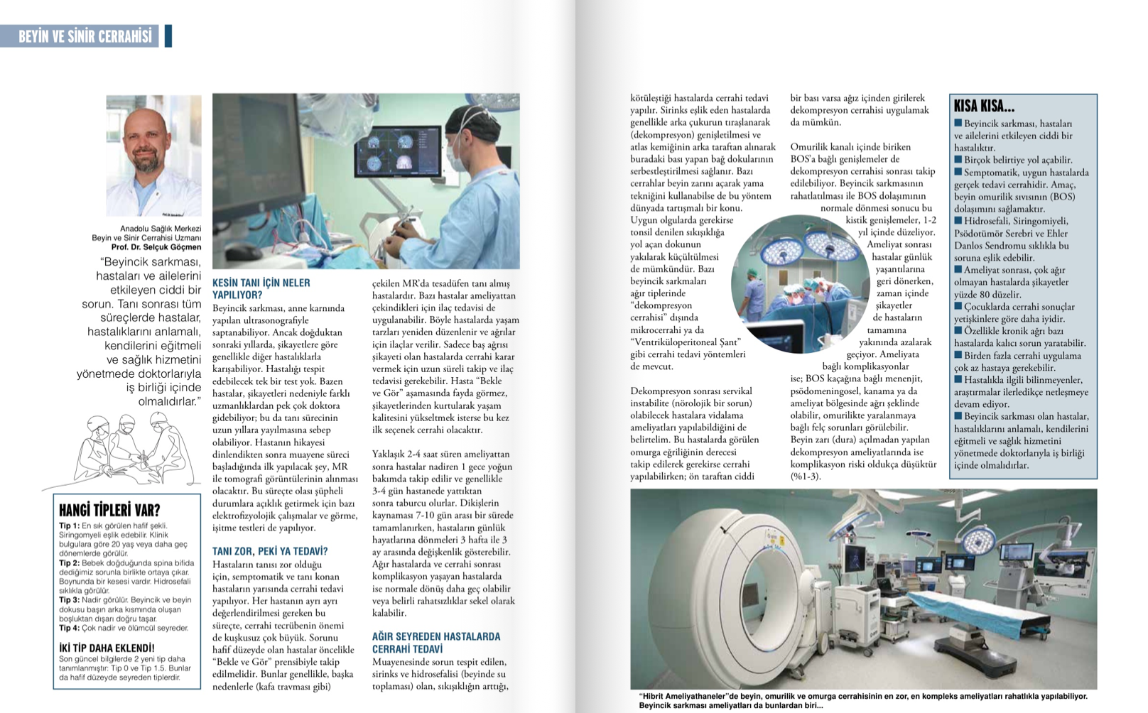 Beyincik Sarkması !!!