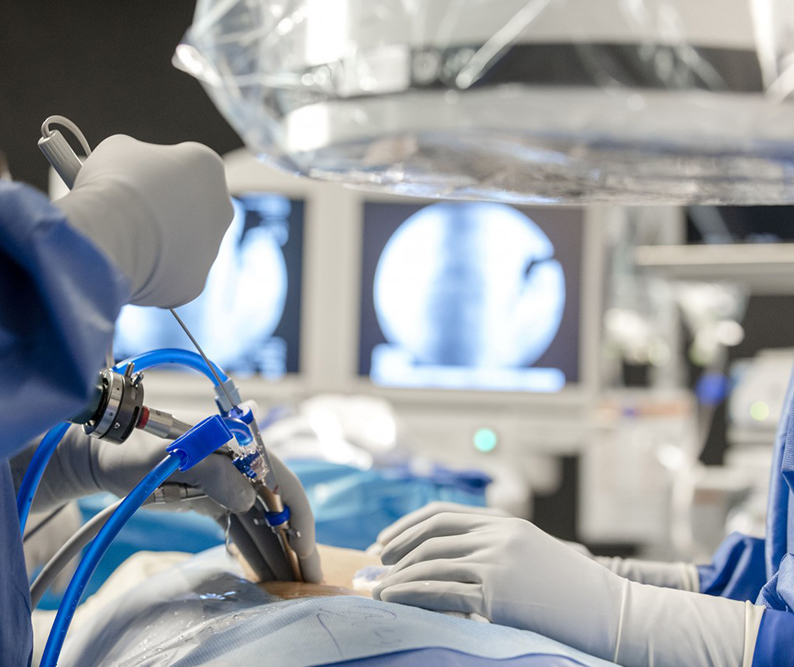 Kapalı Bel Fıtığı Ameliyatı Endoskopik